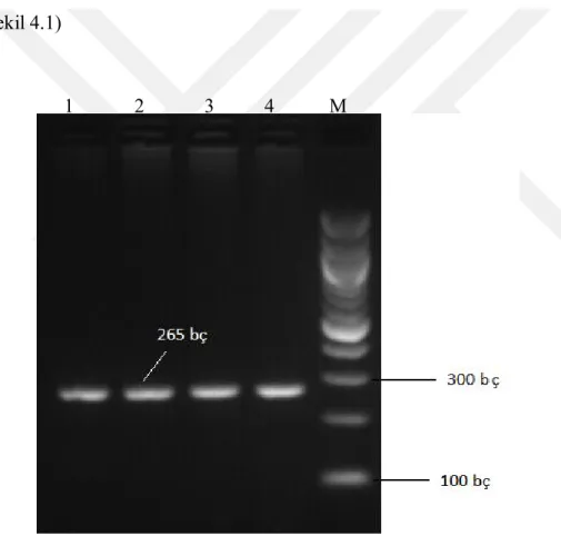 Şekil 4.1. IGF-I ekson 1 gen bölgesi PCR ürünü 