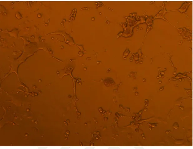 Şekil 4. 2. RSV’nin HEp-2 hücreleri üzerinde yaptığı CPE’lerin mikroskop görüntüsünün 