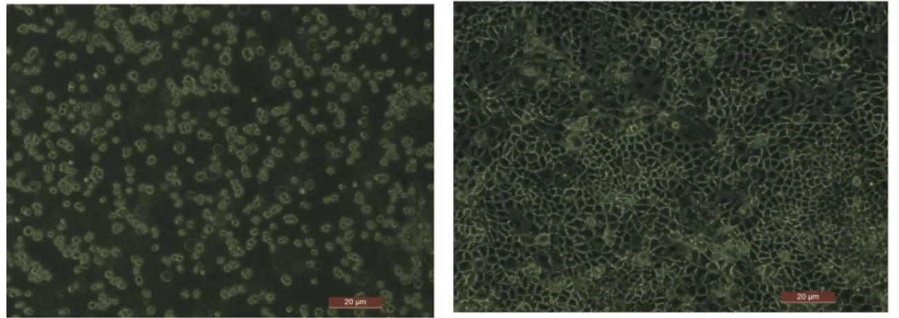 Şekil 3.5.Caco-2 kolon  kanseri hücrelerinin ekimi yapıldığı andan itibaren aşama aşama  gelişimini gösteren invert mikroskop (10X) görüntüleri