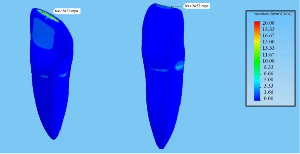 Şekil 3.1. 0°’lik kuvvet altında ana modeldeki stres dağılımları