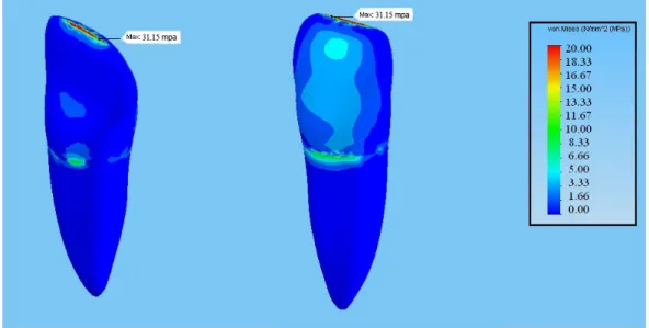 Şekil 3.4. 60°’lik kuvvet altında ana modeldeki stres dağılımları