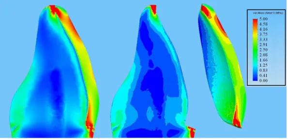 Şekil  3.6.  60°’lik  kuvvet  altında  koronal  kısmın  sagittal  kesitindeki  stres dağılımları