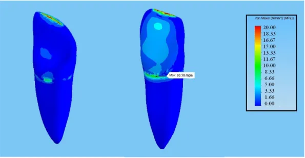 Şekil 3.22. 60°’lik kuvvet altında ana modeldeki stres dağılımları