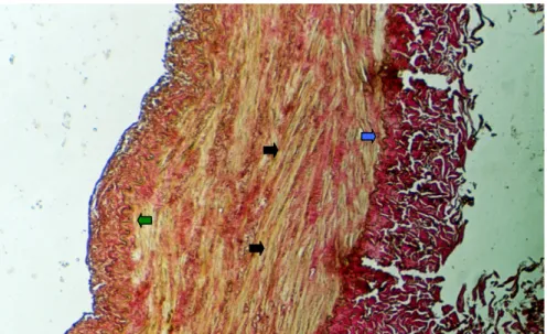 Şekil 2. RA’in histolojik yapısı, mediasında çok sayıda düz kas hücreleri (siyah oklar)   ve daha az sayıda elastik lif içeriyor