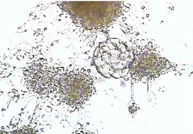 Şekil 2 : Petri kabında gelişiminin 3. günündeki  embriyonun genişlemiş ve yayılmış kumulus hücreleri  ile sımsıkı  sarılması ve embriyo ile dentritik iletişimi   (Parikh et.al ; Cumulus-aided embryo transfer