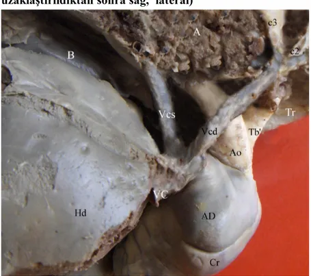 Şekil 12: Kalbe giren - çıkan damarların görünümü (sağ ve lateral)
