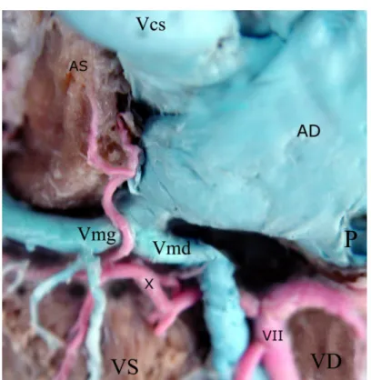 Şekil 21: Sinus coronarius’un görünümü (latex)