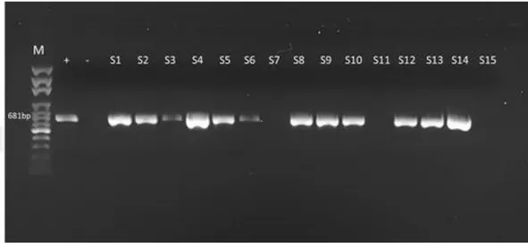 Şekil 3.5. PCR ürünlerinin elektroforez görüntüsü. 
