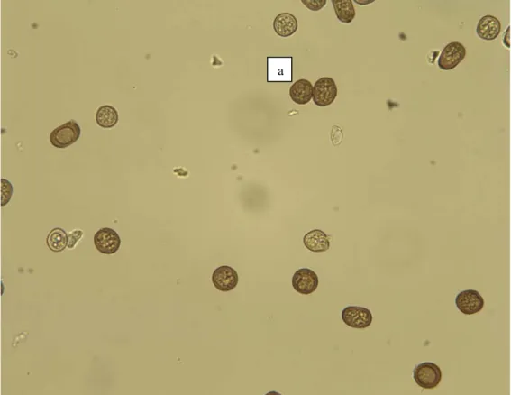 Şekil 3. Tilletia spp. Klamidosporları (Teliosporları)   