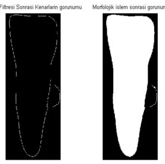 Şekil 2.6 Morfolojik işlem sonrası görünüm 