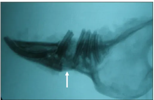 Şekil 4.3. Direk radyografide yeni oluşan kemik bölgesi 