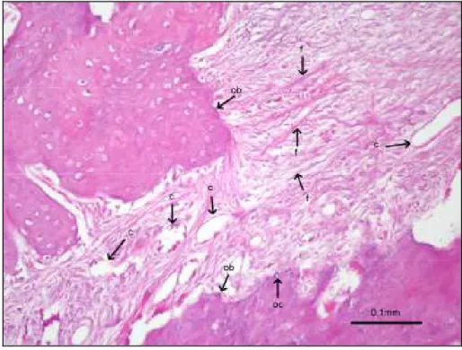 Şekil 4.6. Yeni oluşan kemik bölgesinin histolojik görüntüsü,  ob)osteoblast  oc)osteoklast   f)fibroblast  c)kollajen (HE) 