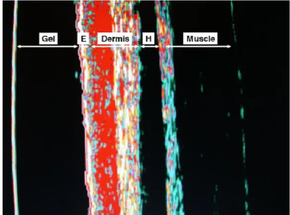 Şekil 4.2 20 MHz renkli ultrasonografi ile deri ve deri altı katmanlarının görünümü  (Laurent  ve ark