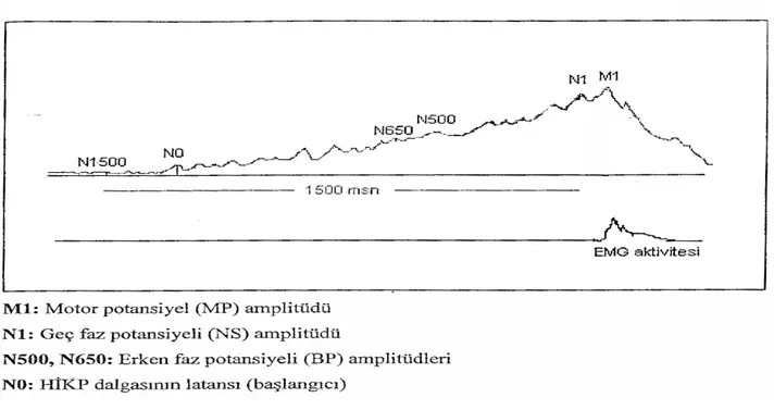 Şekil 3: DİP dalgasının şematik görünümü ve analiz edilen parametreler  4.4. İstatistik Yöntemi 