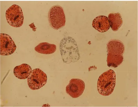 Şekil 13: Grup 1 mikrobiyoloji çalışmasından bir preperatın ışık mikroskobundaki  görüntüsü