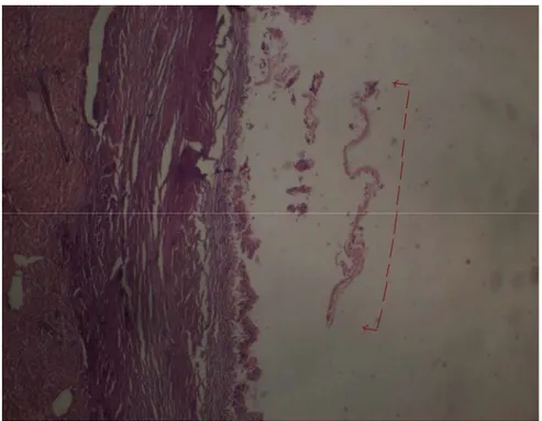 Şekil 16:  Grup 2 çalışmasına ait bir preperatta solda karaciğer parankimi ve sağda  kist hidatiğe ait dokular görülmektedir