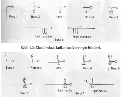 Şekil 1.4: Maksillada kullanılacak springin bükümü. 