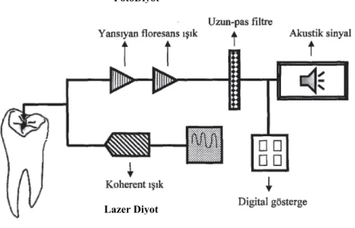 Şekil 1.2 DĐAGNOdent’in çalışma prensibi (Akgün 2005). 