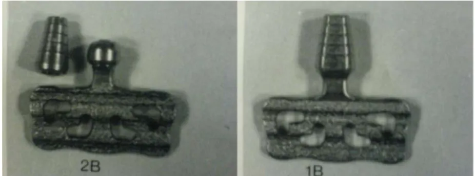 Şekil 2: Blade-vent dental implant  ( Fonseca, Davis  1995) 