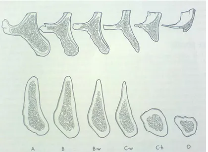 Şekil 6: Alt ve üst çene kemiğinin şekillerine göre divizyonları (Mish 1999) 
