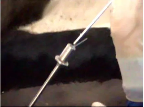 Şekil 3.18. Toggle pin ipinin abdominal boşluğa salınması (A, B) (1: abdominal duvar, 2: 