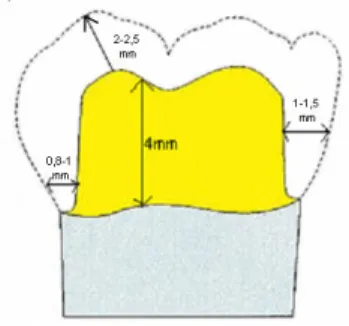 Şekil 2.7. Posterior bir diş preparasyonunun şematik görüntüsü  