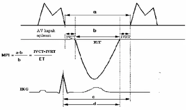 Şekil 7: Pulse Doppler ekokardiyografi  ile MPI ölçümü  