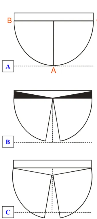 Şekil 2.3.  Horizontal düzlemde üst çene genişletmesinin biyomekaniği. Yarım  daire üst çenenin sağ ve sol yarılarını, dikdörtgen posterior komşu kemikleri temsil  etmekte (A)