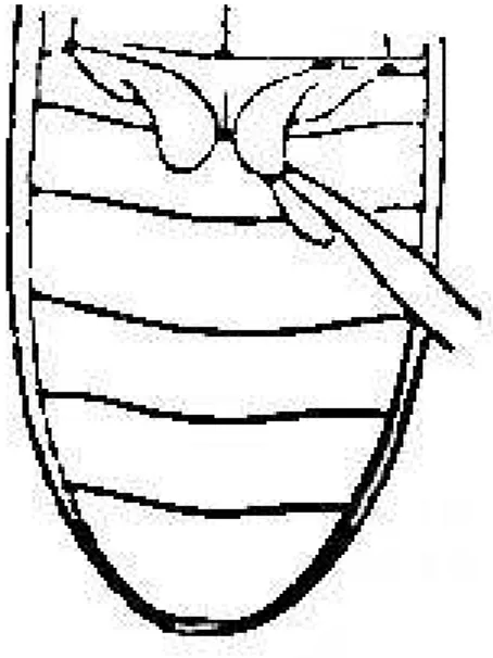 Şekil 4.6. Adephaga alt takımında 1. abdomen sterniti üzerinde coxa’nın görünüşü