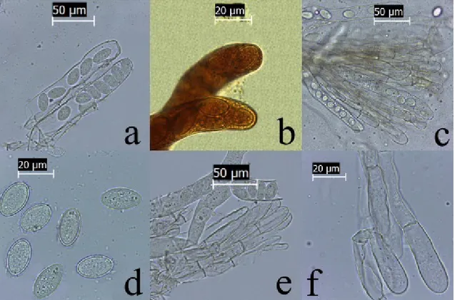 Figure  2.  Morchella  populiphila  a.  Asci  in  distilled  water,  b.  Asci  apices  in  IKI,  c