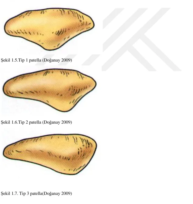 Şekil 1.5.Tip 1 patella (Doğanay 2009)