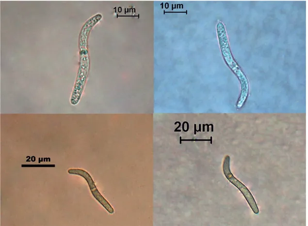 Figure 3. Spores of Lasiosphaeria ovina Discussion