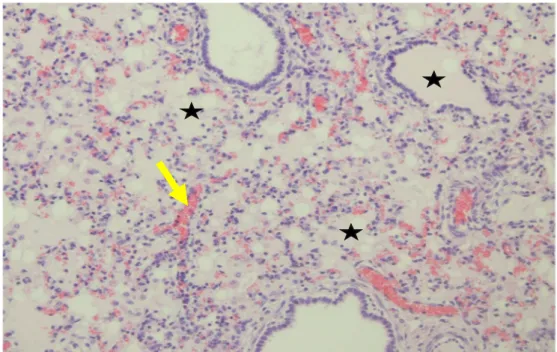 Şekil  3.14.  İnteralveoler  kapillar  damarlarda  hiperemi  (ok)  ve  MNH  infiltrasyonu  (yıldız)