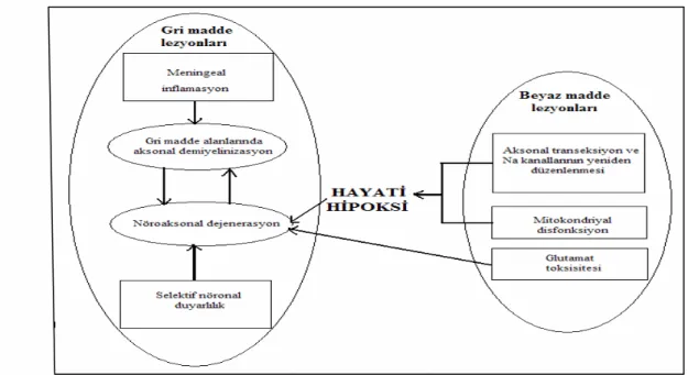 Şekil  2: MS’de gri madde hasarının şematik anlatımı (13) 