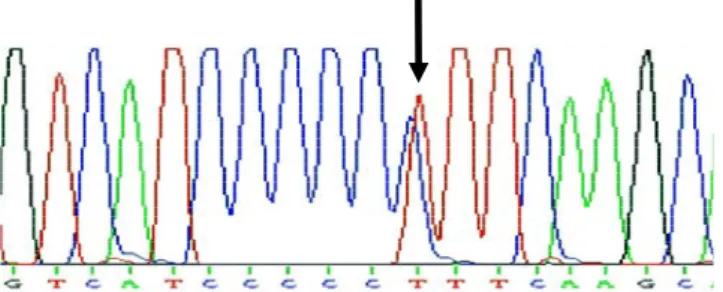 Şekil 4.2. Heterozigot Pro279Leu mutasyonuna sahip bireyin DNA dizi analizi grafiği 
