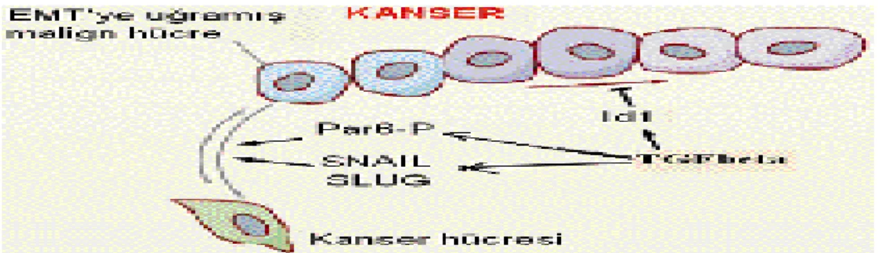 Şekil 1.2. TGF- β’nın epitelyal-mezenkimal geçişi ve progenitör hücrenin kanser hücresine  dönüşümündeki rolü