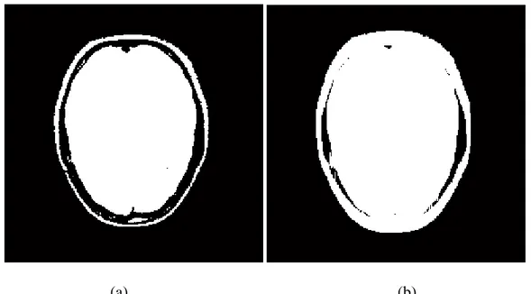 Şekil 4.6 MIDAS veri tabanından alınmış (a) aksiyel kesitli ikili formda MRG beyin  görüntüsü (b) aynı görüntünün genişleme işleminden sonraki hali  