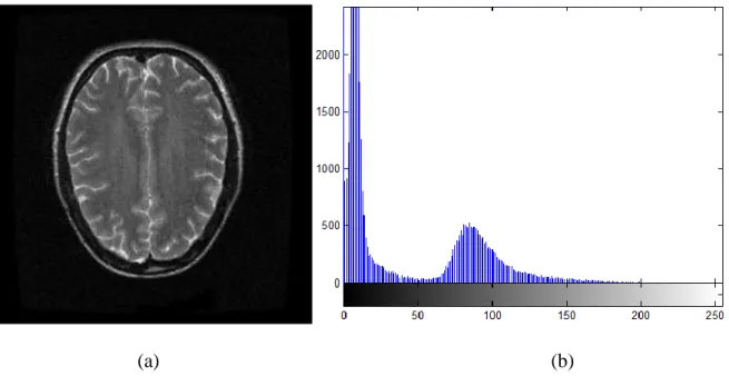 Şekil 4.8  Aksiyal kesitte elde edilmiş beyin görüntüsü (a) görüntü,    (b)  aynı görüntünün histogramı 