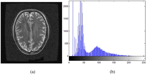 Şekil 4.10 Aksiyal kesitte elde edilmiş beyin görüntüsünün (a)  adaptif histogram eşitleme  işleminden sonraki hali (b)  aynı görüntünün histogramı 
