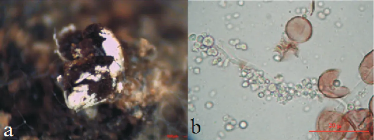 Şekil 2. Didymium trachysporum. (a) Sporofor; (b) Kapillitium ve spor görüntüleri