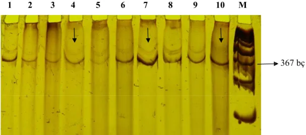 Şekil 8.  PTEN geni ekzon 2’de SSCP tekniği sonrası farklı gözlenen bantların  poliakrilamid jel fotoğrafı