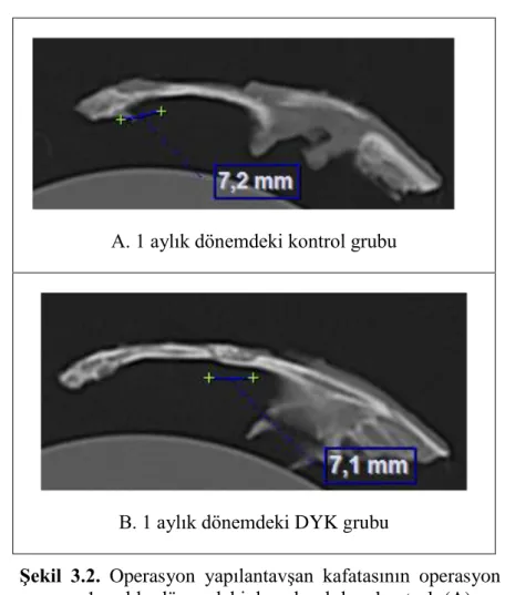 ġekil  3.2.  Operasyon  yapılantavĢan  kafatasının  operasyon  sonrası  1  aylık  dönemdeki  boĢ  bırakılan  kontrol  (A)  ve  DYK grubu (B) BT görüntüleri