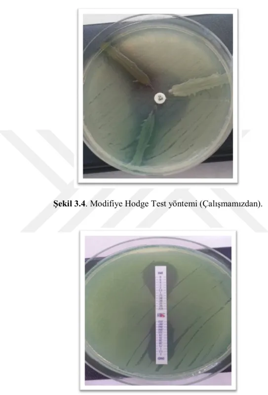 Şekil 3.4. Modifiye Hodge Test yöntemi (Çalışmamızdan). 