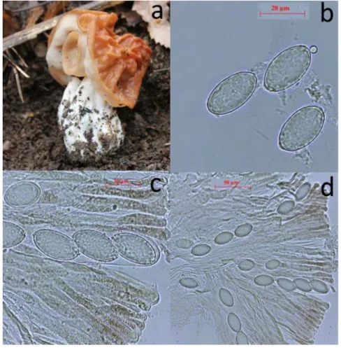Figure 2. Macroscopic and Microscopic characters of Gyromitra brunnea.  