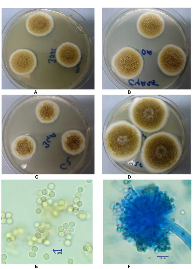 Şekil 4. Aspergillus dimorphicus A. MEA B. CYA25 C. CZ D. CY20S besiyerlerinde 7 günlük koloni görünümleri E