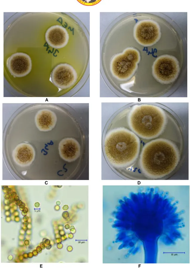 Şekil 5. Aspergillus europaeus A. MEA B. CYA25 C. CZ D. CY20S besiyerlerinde 7 günlük koloni görünümleri E