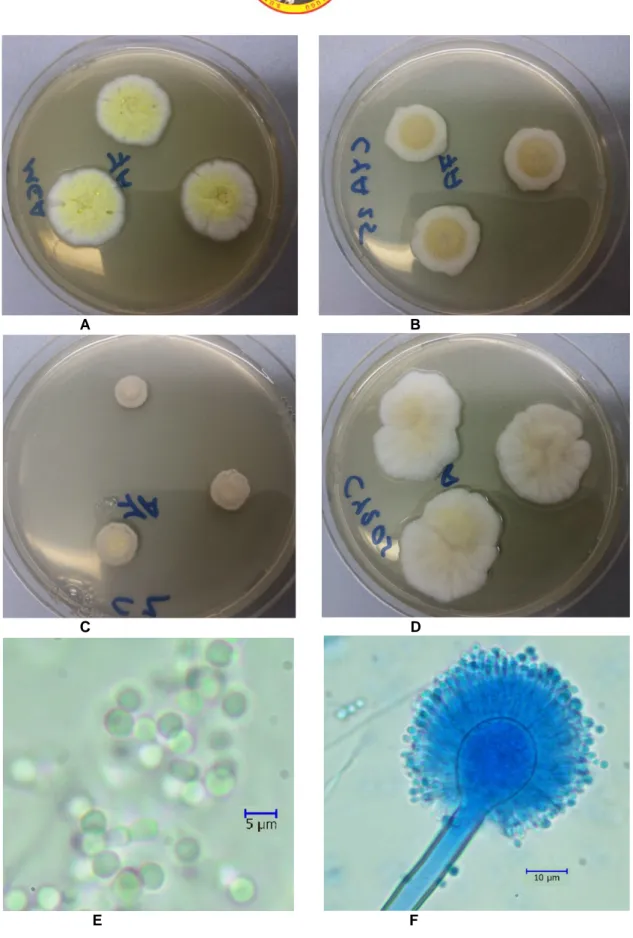 Şekil 6. Aspergillus spelaeus A. MEA B. CYA25 C. CZ D. CY20S besiyerlerinde 7 günlük koloni görünümleri E