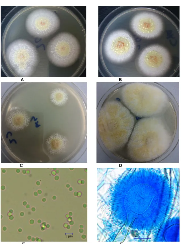 Şekil 1. Aspergillus affinis A. MEA B. CYA25 C. CZ D. CY20S besiyerlerinde 7 günlük koloni görünümleri E