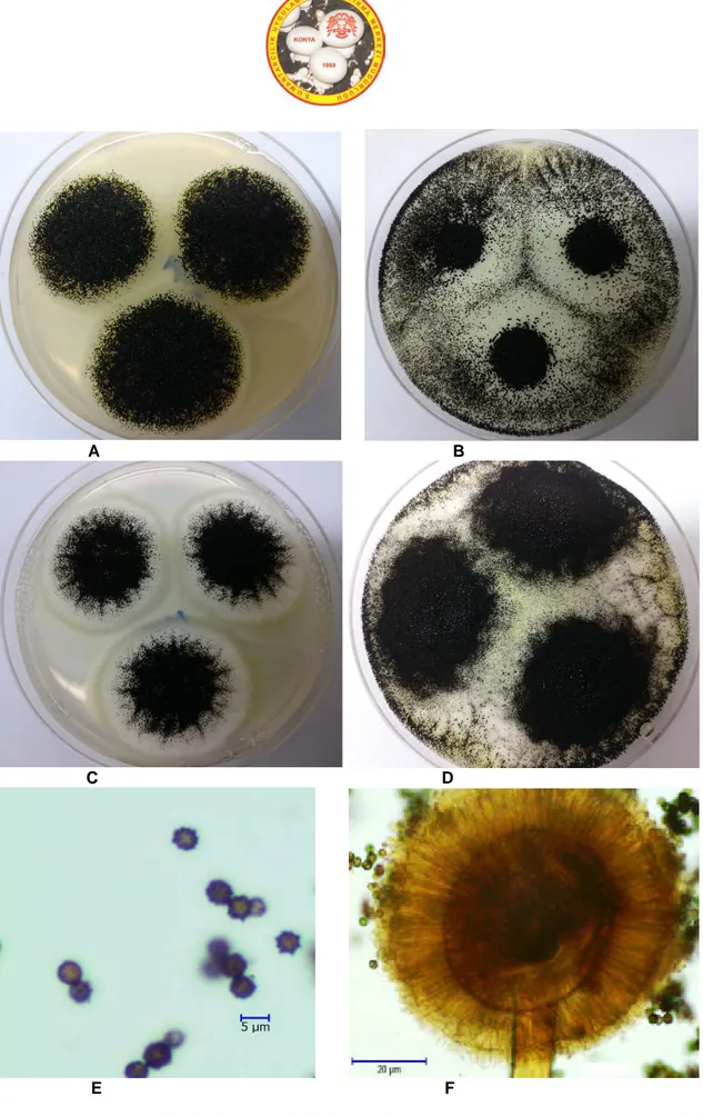 Şekil 2. Aspergillus awamori A. MEA B. CYA25 C. CZ D. CY20S besiyerlerinde 7 günlük koloni görünümleri E