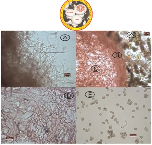 Figure 2. A-Mycelial layer on exoperidium, B-Intermediate part on exoperidium,   C- pseudoparenchymatous structure on exoperidium, D-Endoperidium, E-Spores